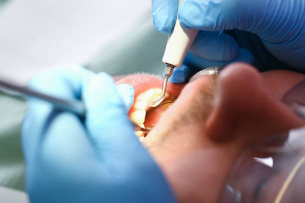 Best Emergency Dental Care for Broken or Chipped Teeth in Dresser, WI